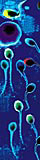 Так выглядят сперматозоиды и яйцеклетка под электронным микроскопом